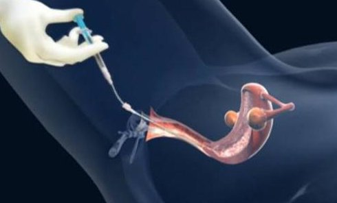 南昌最受欢迎的三大助孕机构，2026年南昌有哪些正规助孕公司